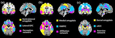 Age-Related Structural Alterations in Human Amygdala Networks: Reflections on Correlations Between White Matter Structure and Effective Connectivity